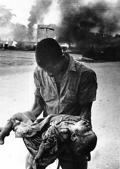 Child Casualty of the Nigeria-Biafra War