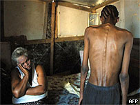 Aids patient