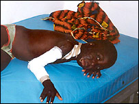 Child facing surgery
